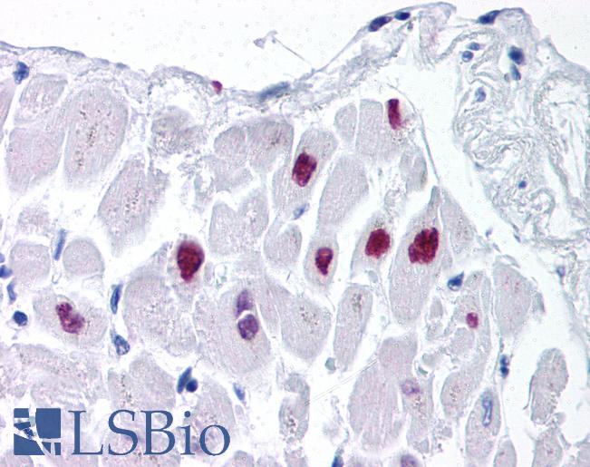 Anti-HDAC2 antibody IHC of human heart. Immunohistochemistry of formalin-fixed, paraffin-embedded tissue after heat-induced antigen retrieval. Antibody LS-B965 concentration 5 ug/ml.