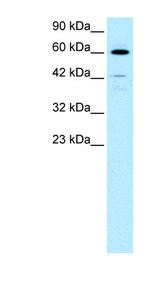 HDAC2 antibody LS-B965 Western blot of Jurkat lysate.
