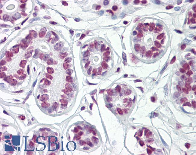 Anti-HDAC2 antibody IHC of human breast. Immunohistochemistry of formalin-fixed, paraffin-embedded tissue after heat-induced antigen retrieval. Antibody LS-B8044 dilution 5-7.5 ug/ml.