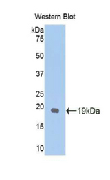 Western blot of recombinant GPC1 / Glypican.