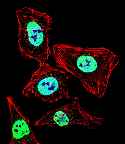 Fluorescent confocal image of HeLa cell stained with HDAC2 Antibody. HeLa cells were fixed with 4% PFA (20 min), permeabilized with Triton X-100 (0.1%, 10 min), then incubated with HDAC2 primary antibody (1:25, 1 h at 37°C). For secondary antibody, Alexa Fluor 488 conjugated donkey anti-rabbit antibody (green) was used (1:400, 50 min at 37°C). Cytoplasmic actin was counterstained with Alexa Fluor 555 (red) conjugated Phalloidin (7units/ml, 1 h at 37°C). Nuclei were counterstained with DAPI (blue) (10 ug/ml, 10 min). HDAC2 immunoreactivity is localized to Nucleus significantly.