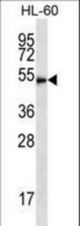 HDAC3 Antibody western blot of HL-60 cell line lysates (35 ug/lane). The HDAC3 antibody detected the HDAC3 protein (arrow).