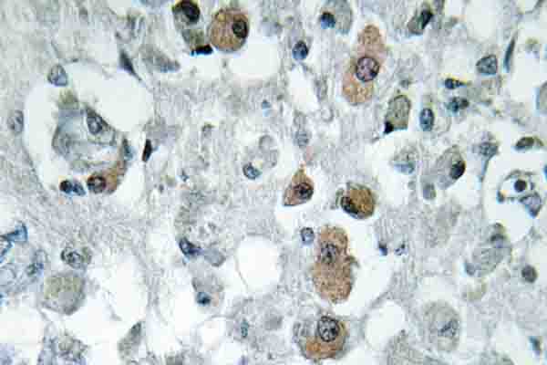 IHC of GNPAT (F365) pAb in paraffin-embedded human brain tissue.