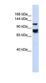 HDAC4 antibody LS-C109882 Western blot of HeLa lysate.