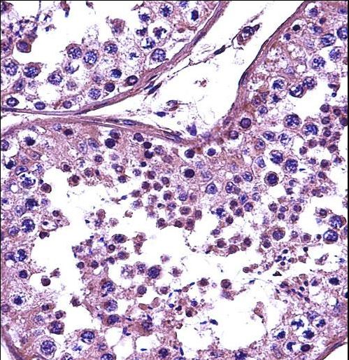 HDAC4 Antibody immunohistochemistry of formalin-fixed and paraffin-embedded human testis tissue followed by peroxidase-conjugated secondary antibody and DAB staining.