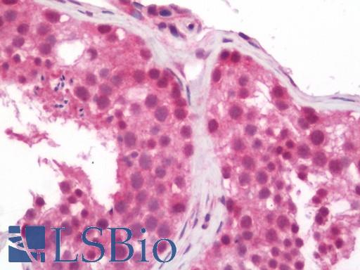 Human Testis: Formalin-Fixed, Paraffin-Embedded (FFPE)