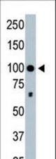 The anti-HDAC4 antibody is used in Western blot to detect HDAC4 in mouse brain tissue lysate.