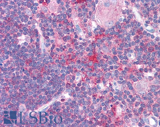 Anti-HDAC6 antibody IHC of human thymus. Immunohistochemistry of formalin-fixed, paraffin-embedded tissue after heat-induced antigen retrieval. Antibody LS-B966 concentration 5 ug/ml.