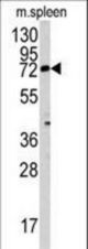 Western blot of MGAT3 antibody in mouse spleen tissue lysates (35 ug/lane). MGAT3 (arrow) was detected using the purified antibody.