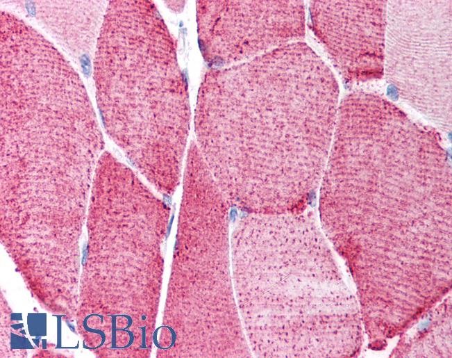 Anti-HDAC6 antibody IHC of human skeletal muscle. Immunohistochemistry of formalin-fixed, paraffin-embedded tissue after heat-induced antigen retrieval. Antibody LS-B966 concentration 5 ug/ml.