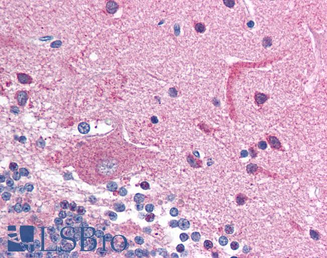 Anti-HDAC6 antibody IHC of human brain, cerebellum. Immunohistochemistry of formalin-fixed, paraffin-embedded tissue after heat-induced antigen retrieval. Antibody LS-B966 concentration 5 ug/ml.