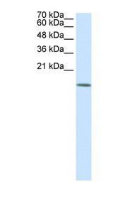 HDAC6 antibody LS-B966 Western blot of 293T cell lysate.