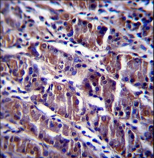 HDAC7 Antibody immunohistochemistry of formalin-fixed and paraffin-embedded human stomach tissue followed by peroxidase-conjugated secondary antibody and DAB staining.