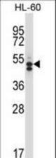 HDAC7 Antibody western blot of HL-60 cell line lysates (35 ug/lane). The HDAC7 antibody detected the HDAC7 protein (arrow).
