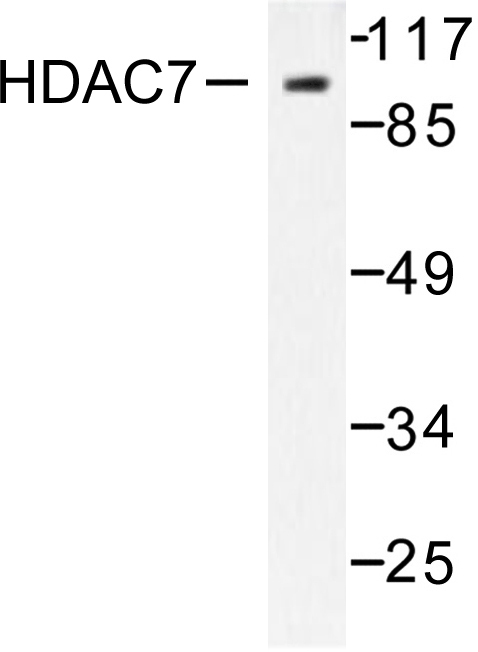 Western blot of HDAC7 (G932) pAb in extracts from HUVEC cells.