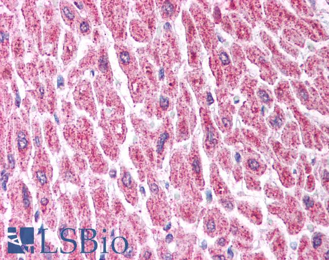Anti-HDAC8 antibody IHC of human heart. Immunohistochemistry of formalin-fixed, paraffin-embedded tissue after heat-induced antigen retrieval. Antibody LS-B967 concentration 5 ug/ml.