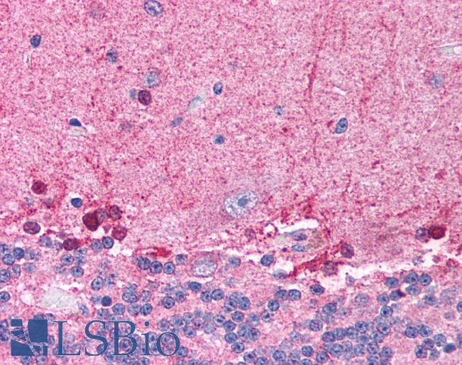 Anti-HDAC8 antibody IHC of human brain, cerebellum. Immunohistochemistry of formalin-fixed, paraffin-embedded tissue after heat-induced antigen retrieval. Antibody LS-B967 concentration 5 ug/ml.