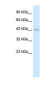 HDAC8 antibody LS-B967 Western blot of Jurkat lysate.