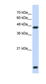 HDAC8 antibody LS-C109935 Western blot of Transfected 293T cell lysate.