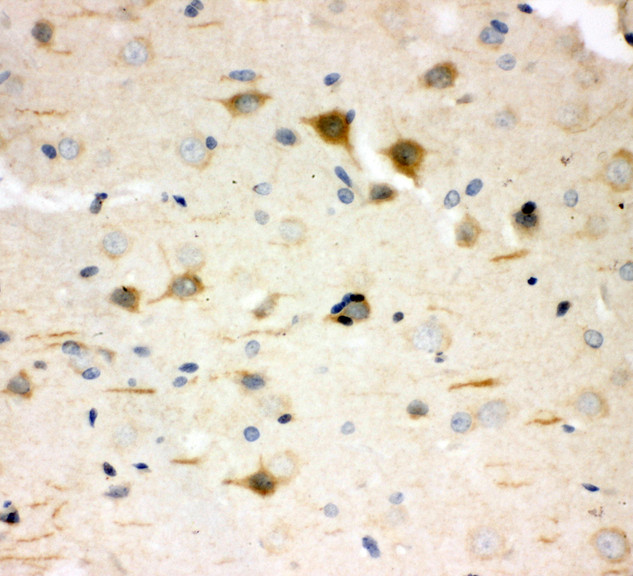 HDC / Histidine Decarboxylase antibody. IHC(P): Rat Brain Tissue.