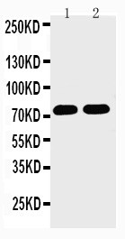 WB of HDC / Histidine Decarboxylase antibody. All lanes: Anti-HDC at 0.5ug/ml. Lane 1: Rat Brain Tissue Lysate at 40ug. Lane 2: Mouse Brain Tissue Lysate at 40ug. Predicted bind size: 74KD. Observed bind size: 74KD.