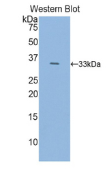 Western blot of recombinant HDC / Histidine Decarboxylase.