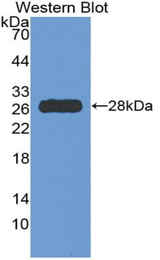 Western blot of recombinant HDC / Histidine Decarboxylase.