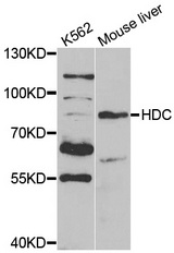Western blot analysis of extracts of mouse liver, using HDC antibody.