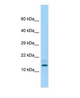 Western blot of Hddc3 Antibody - middle region in Rat Testis cells lysate.