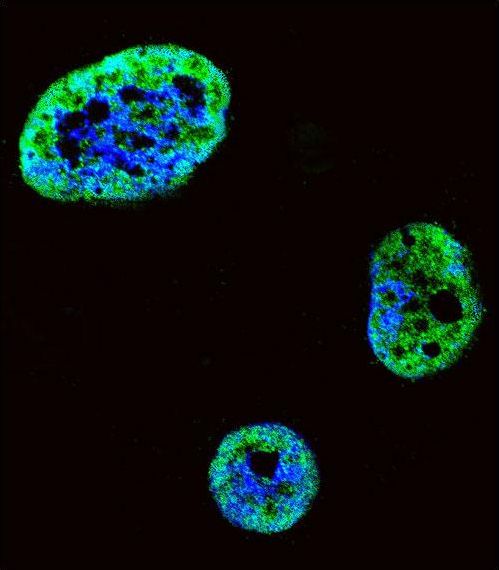 Confocal immunofluorescent of HDGF Antibody with SK-BR-3 cell followed by Alexa Fluor 488-conjugated goat anti-rabbit lgG (green). DAPI was used to stain the cell nuclear (blue).