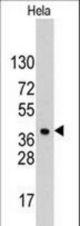 Western blot of anti-HDGF antibody in HeLa cell line lysates (35 ug/lane). HDGF(arrow) was detected using the purified antibody.