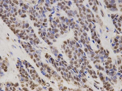 Immunohistochemistry of paraffin-embedded human stomach using HDGF antibody at dilution of 1:200 (400x lens).