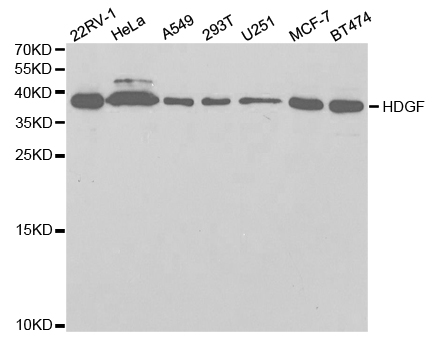 Western blot analysis of extracts of various cell lines, using HDGF antibody.