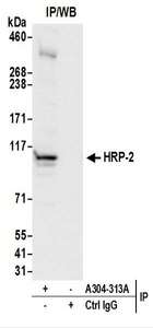 Detection of Human HRP-2 by Western Blot of Immunoprecipitates. Samples: Whole cell lysate (0.5 or 1.0 mg per IP reaction; 20% of IP loaded) from 293T cells. Antibodies: Affinity purified rabbit anti-HRP-2 antibody used for IP at 6 ug per reaction. For blotting immunoprecipitated HRP-2, was used at 1 ug/ml. Detection: Chemiluminescence with an exposure time of 10 seconds.
