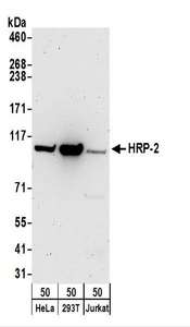 Detection of Human HRP-2 by Western Blot. Samples: Whole cell lysate (50 ug) from HeLa, 293T, and Jurkat cells. Antibodies: Affinity purified rabbit anti-HRP-2 antibody used for WB at 1 ug/ml. Detection: Chemiluminescence with an exposure time of 3 minutes.