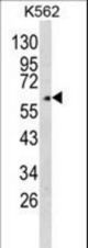 Western blot of GPC4 Antibody in K562 cell line lysates (35 ug/lane). GPC4 (arrow) was detected using the purified antibody.