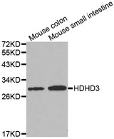 Western blot analysis of extracts of various cell lines, using HDHD3 antibody.