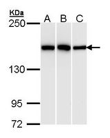 Sample (30 ug of whole cell lysate). A: Hela. B: Hep G2. C: Raji. 5% SDS PAGE. HDLBP antibody diluted at 1:1000.