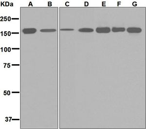 Western blot analysis on (A) HepG2, (B) 293T, (C) Jurkat, (D) HeLa, (E) RAW 264.7, (F) PC-12, and (G) NIH/3T3 cell lysates using anti-HDLBP antibody.