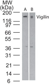 Western blot of Vigilin in A) Jurkat cell lysate and B) RAW cell lysate using LS-C148530 at 3 and 5 ug/ml, respectively. Goat anti-rabbit Ig HRP secondary antibody, and PicoTect ECL substrate solution, were used for this test.