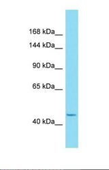 Western blot of Human 721_B. HEATR6 antibody dilution 1.0 ug/ml.