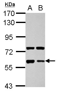 Sample (30 ug of whole cell lysate) A: NT2D1 B: SK-N-SH 7.5% SDS PAGE GPC5 / Glypican 5 antibody diluted at 1:1000