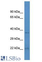 HEBP2 antibody Western Blot of Rat Lung. Antibody dilution: 1 ug/ml.
