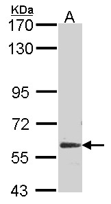 Sample (30 ug of whole cell lysate). A: NT2D1. 7.5% SDS PAGE. Glypican 5 antibody. Glypican 5 / GPC5 antibody diluted at 1:500.