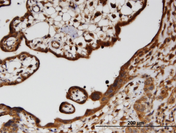 Immunoperoxidase of monoclonal antibody to HECTD2 on formalin-fixed paraffin-embedded human placenta. [antibody concentration 3 ug/ml]