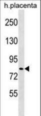 HECTD2 Antibody western blot of human placenta tissue lysates (35 ug/lane). The HECTD2 antibody detected the HECTD2 protein (arrow).