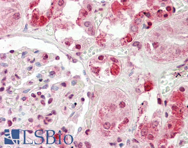 Anti-HECTD2 antibody IHC staining of human kidney. Immunohistochemistry of formalin-fixed, paraffin-embedded tissue after heat-induced antigen retrieval. Antibody LS-B9736 concentration 10 ug/ml.