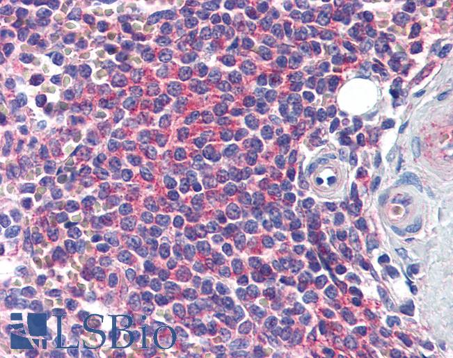 Anti-EDC4 / Ge-1 antibody IHC of human spleen. Immunohistochemistry of formalin-fixed, paraffin-embedded tissue after heat-induced antigen retrieval. Antibody LS-B6221 concentration 3 ug/ml.