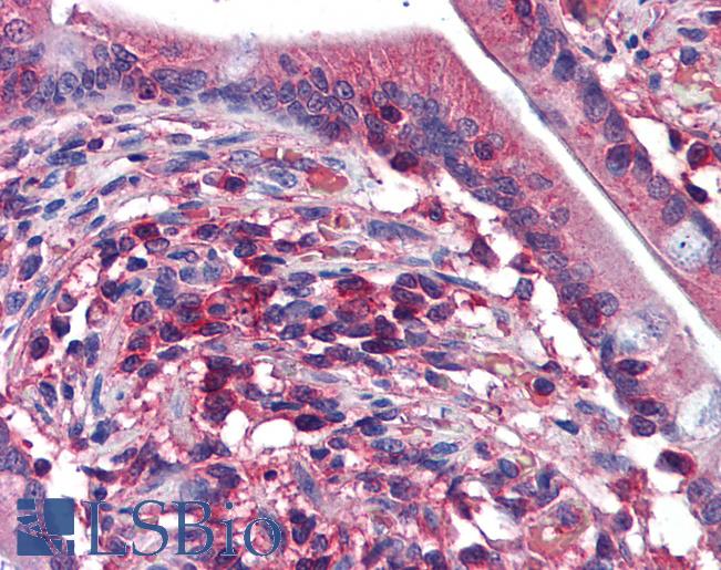 Anti-EDC4 / Ge-1 antibody IHC of human small intestine. Immunohistochemistry of formalin-fixed, paraffin-embedded tissue after heat-induced antigen retrieval. Antibody LS-B6221 concentration 3 ug/ml.