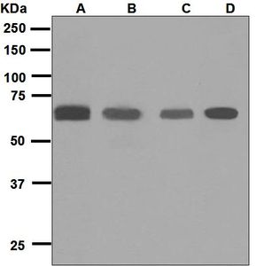 Western blot analysis on (A) A549, (B) fetal lung, (C) HepG2, and (D) C6 lysates using anti-Glypican-5 antibody.
